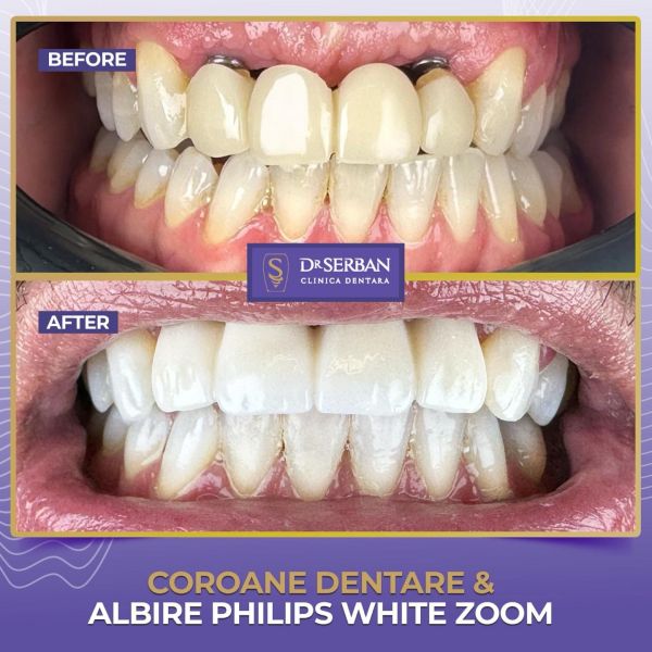 Clinica stomatologică Dr. Serban poza 8