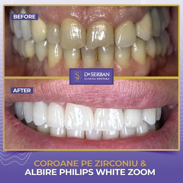 Clinica stomatologică Dr. Serban poza 10