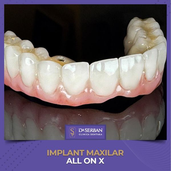 Clinica stomatologică Dr. Serban poza 9