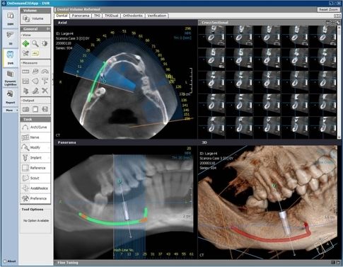 DENTAL ALEX - Centrul de Imagistica si Radiodiagnostic Dentar 3D- strada Prunului poza 5