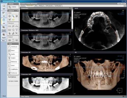 DENTAL ALEX - Centrul de Imagistica si Radiodiagnostic Dentar 3D- strada Prunului poza 6