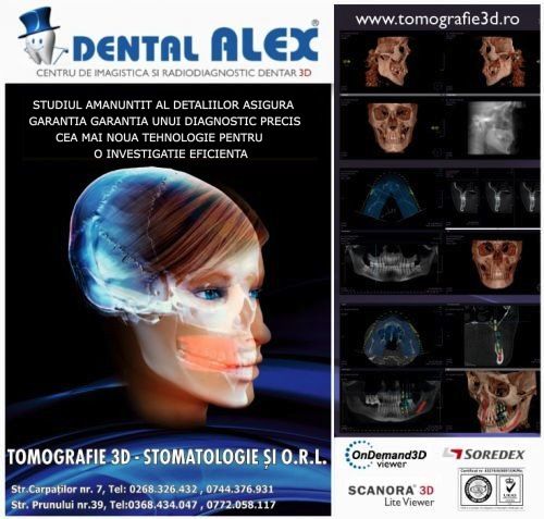 DENTAL ALEX - Centrul de Imagistica si Radiodiagnostic Dentar 3D- strada Prunului poza 0
