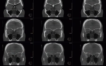 DENTAL ALEX - Centrul de Imagistica si Radiodiagnostic Dentar 3D- strada Prunului poza 7