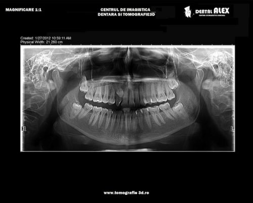 DENTAL ALEX - Centrul de Imagistica si Radiodiagnostic Dentar 3D- strada Prunului poza 9