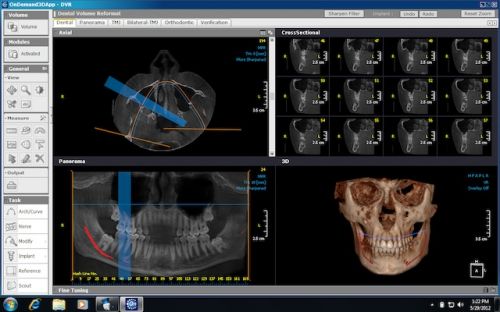 DENTAL ALEX - Centrul de Imagistica si Radiodiagnostic Dentar 3D- strada Prunului poza 4