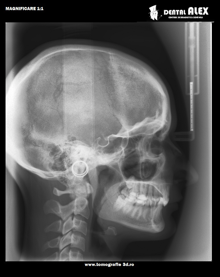 DENTAL ALEX - Centrul de Imagistica si Radiodiagnostic Dentar 3D- strada Prunului poza 11