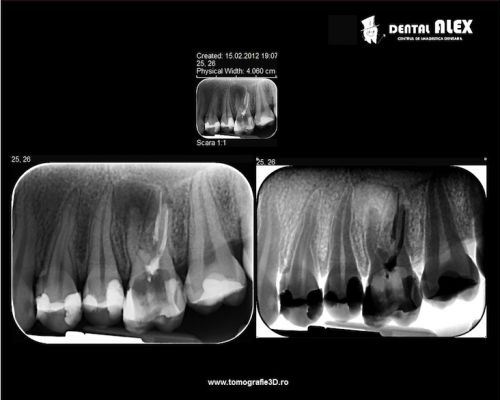 DENTAL ALEX - Centrul de Imagistica si Radiodiagnostic Dentar 3D- strada Prunului poza 10