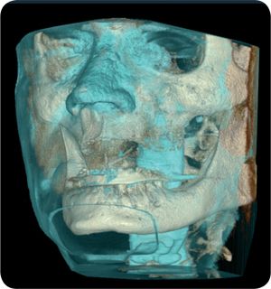DENTAL ALEX - Centrul de Imagistica si Radiodiagnostic Dentar 3D- strada Prunului poza 8