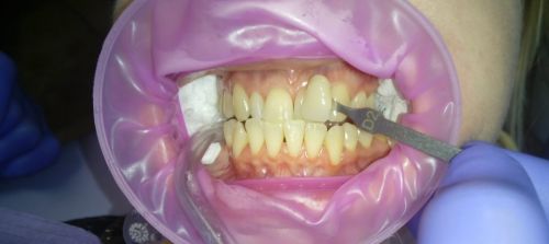 Cabinet Medical de Medicina Dentara Dr.Vanvore Nicoleta poza 9