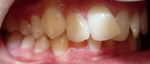 Cabinet Medical de Medicina Dentara Dr.Vanvore Nicoleta poza 5