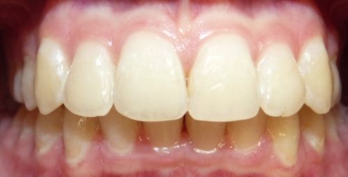 Cabinet Medical de Medicina Dentara Dr.Vanvore Nicoleta poza 6