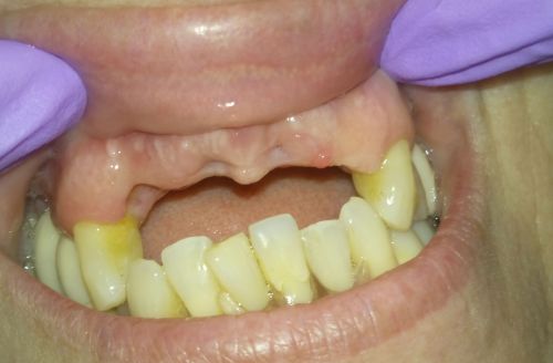 Cabinet Medical de Medicina Dentara Dr.Vanvore Nicoleta poza 7