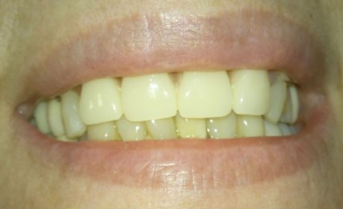 Cabinet Medical de Medicina Dentara Dr.Vanvore Nicoleta poza 8