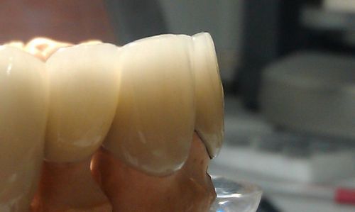 DentDesign poza 1