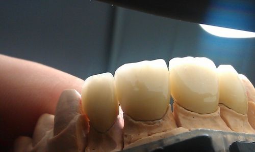 DentDesign poza 3