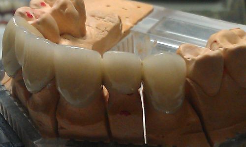 DentDesign poza 4