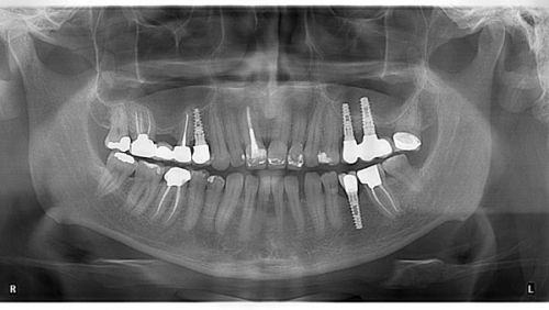 YTS - DENTAL VIEW poza 7