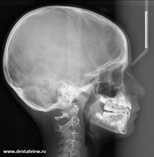 YTS - DENTAL VIEW poza 6