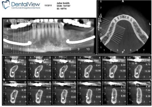 YTS - DENTAL VIEW poza 3