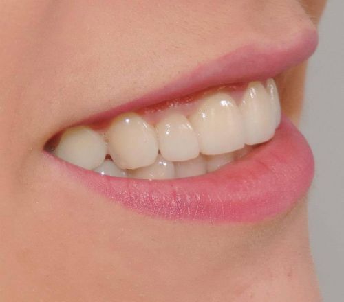 Andreea Dental Studio poza 6