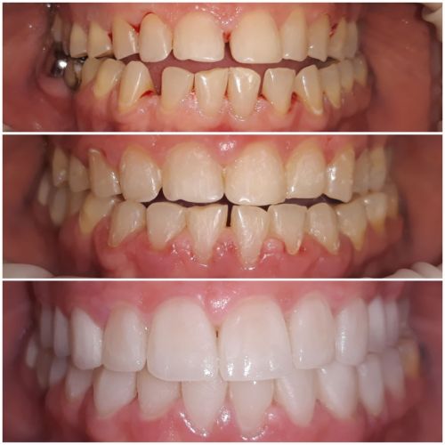 Andreea Dental Studio poza 7