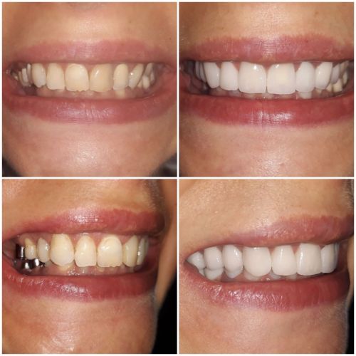 Andreea Dental Studio poza 9