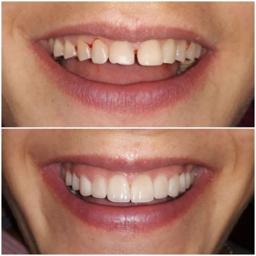 Andreea Dental Studio poza 8