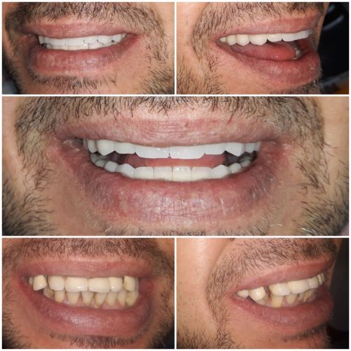 Andreea Dental Studio poza 10