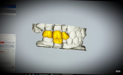 Smile Dental Studio poza 4