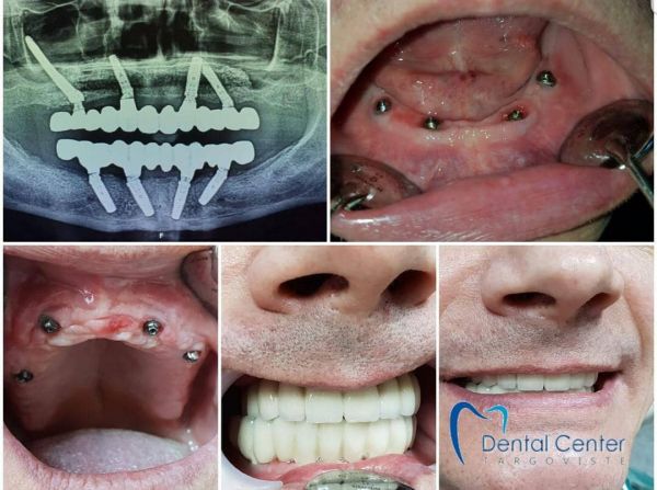 Targoviste Dental Center poza 13