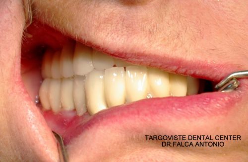 Targoviste Dental Center poza 5