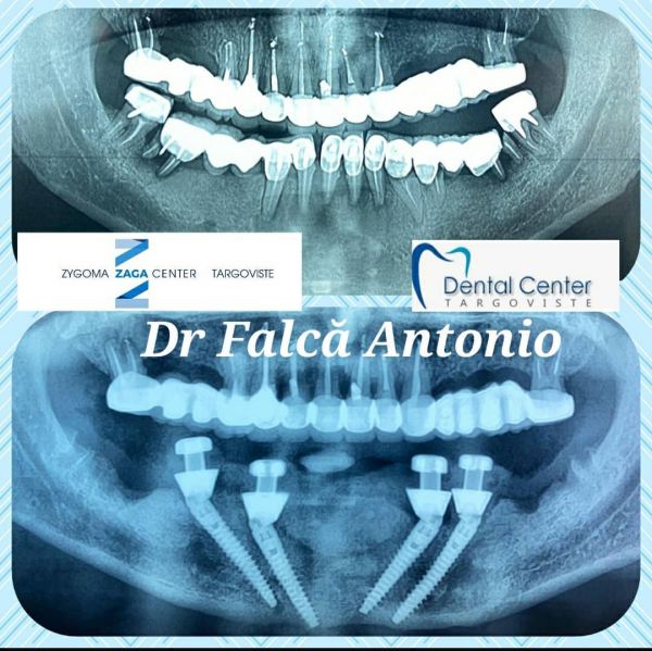 Targoviste Dental Center poza 9