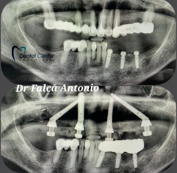 Targoviste Dental Center poza 7