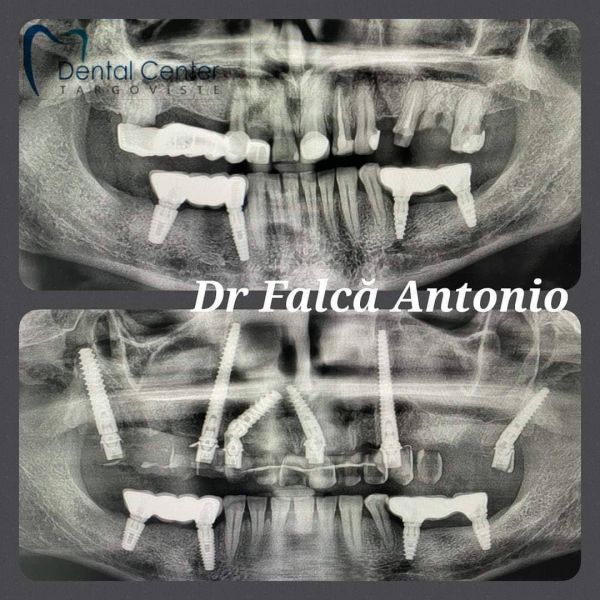 Targoviste Dental Center poza 8