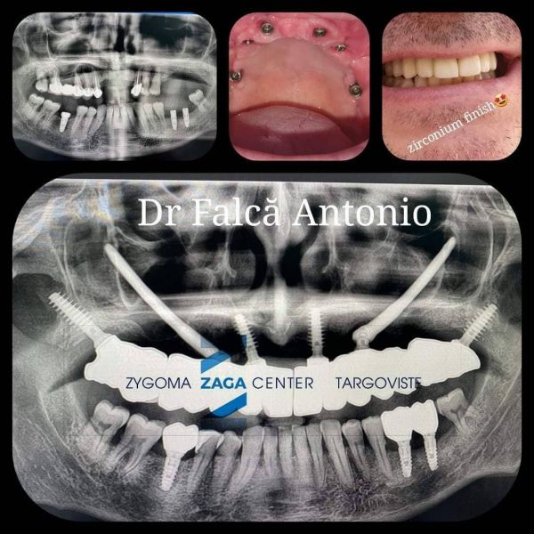 Targoviste Dental Center poza 10