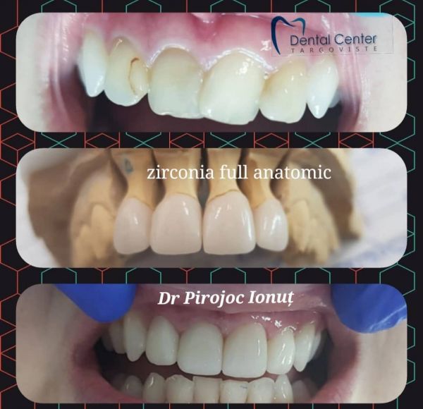 Targoviste Dental Center poza 12