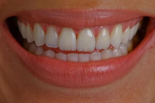 SC ART IMPLANT SRL poza 4