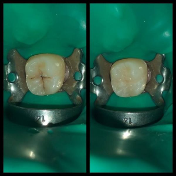 Dental Art - Copou poza 13