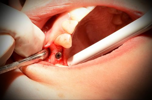 Dental Art - Copou poza 8