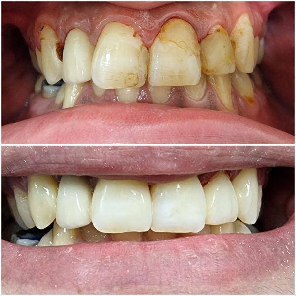 Dental Art - Copou poza 12