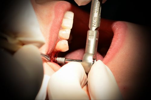 Dental Art - Copou poza 7