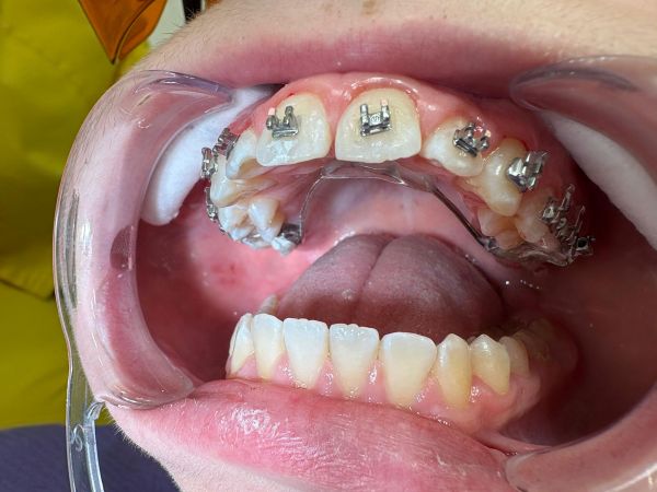 Dental Vision Clinic poza 15