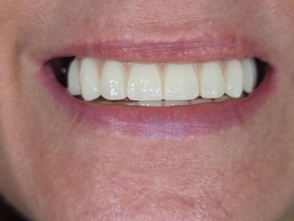 Dental Vision Clinic poza 14