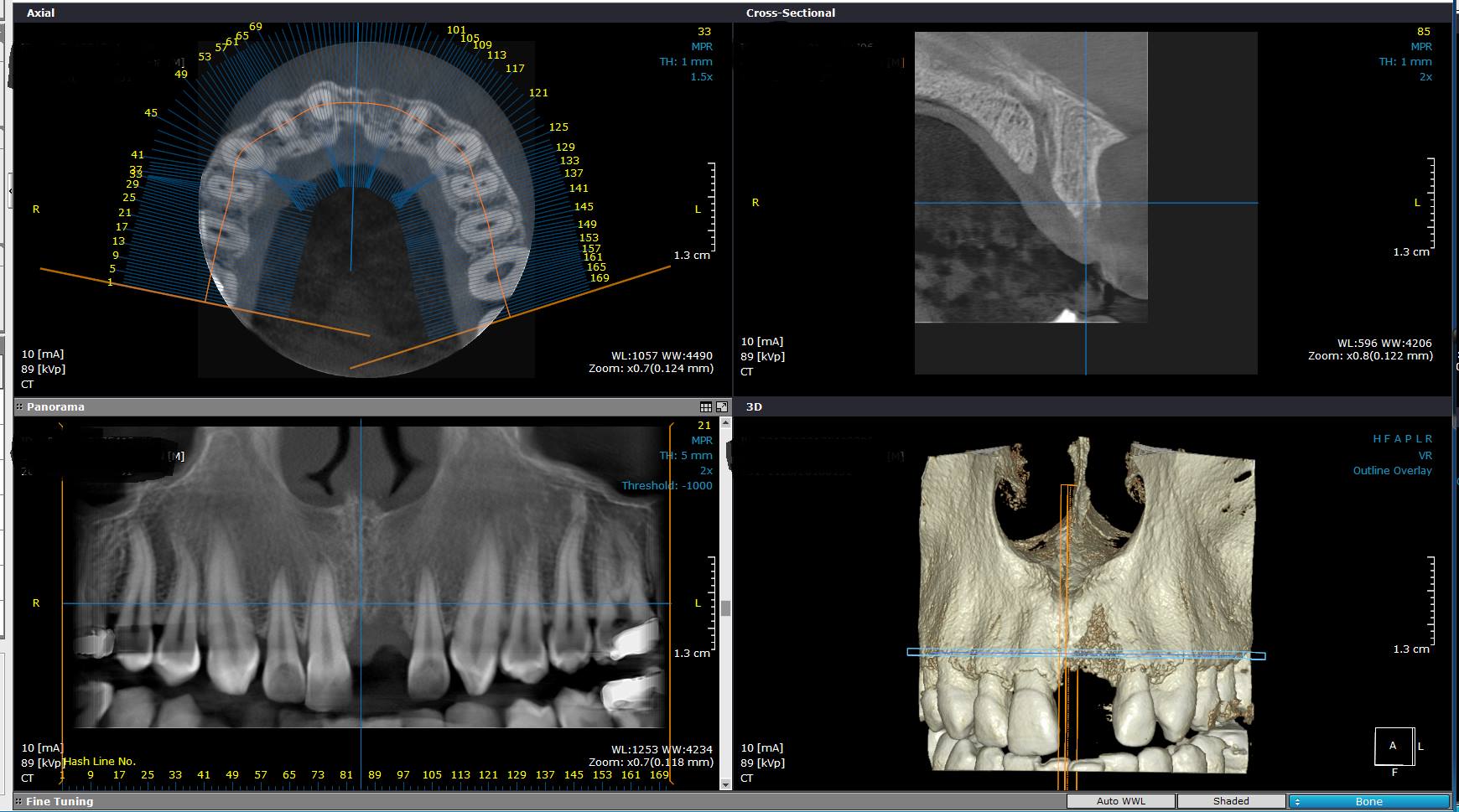 Centru de Radiologie Dentara Barlad poza 2