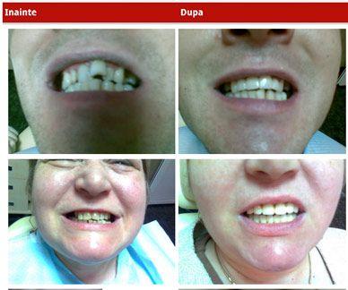 CMI Elena Ciurariu - Medic dentist competenta in implantologie poza 3