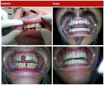 CMI Elena Ciurariu - Medic dentist competenta in implantologie poza 1