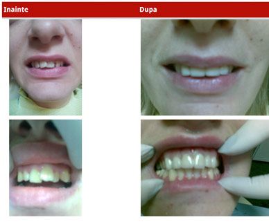 CMI Elena Ciurariu - Medic dentist competenta in implantologie poza 4