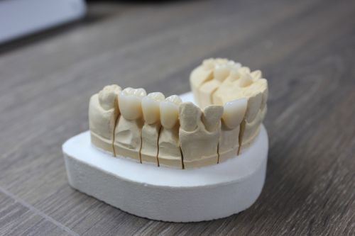 ARNO MILLING CENTER poza 5