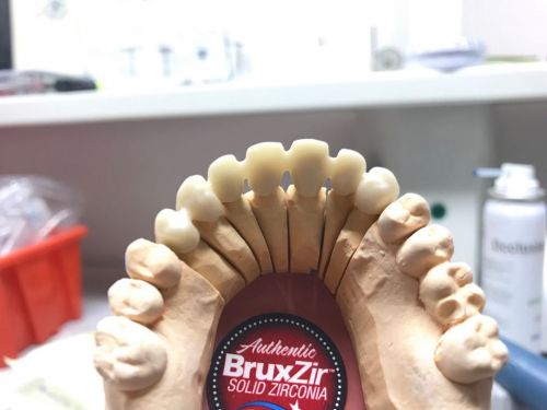 ARNO MILLING CENTER poza 7