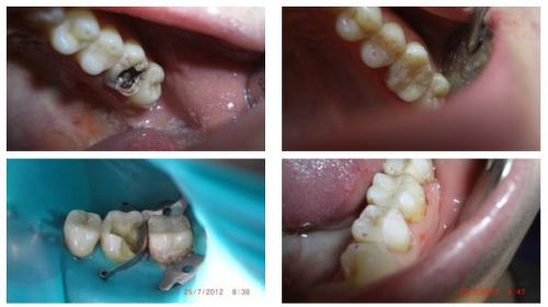 DentisGreen poza 3